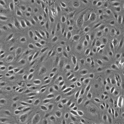 Human Esophageal Microvascular Endothelial Cells