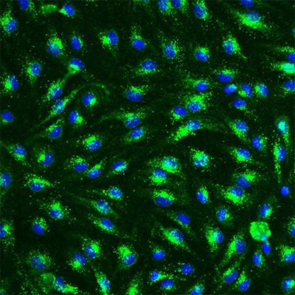 Human Esophageal Microvascular Endothelial Cells