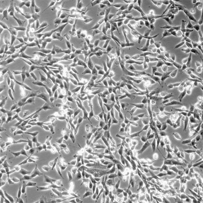 Human Esophageal Smooth Muscle Cells
