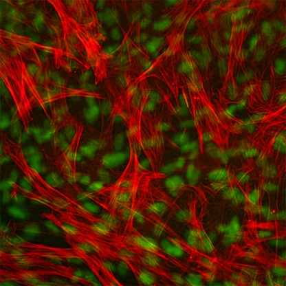 Human Esophageal Smooth Muscle Cells