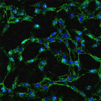 Human Gallbladder Fibroblasts