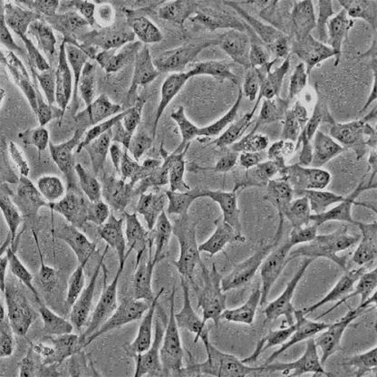 Human Gingival Fibroblasts