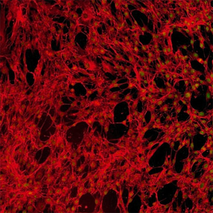 Human Gingival Fibroblasts