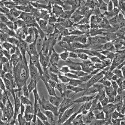 Human Gastric Smooth Muscle Cells