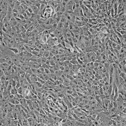 Human Hepatocytes