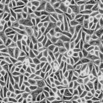 Human Hair Follicular Keratinocytes