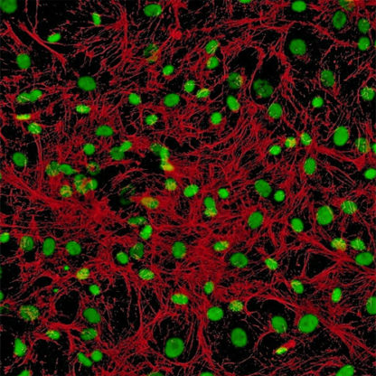 Human Hair Germinal Matrix Cells