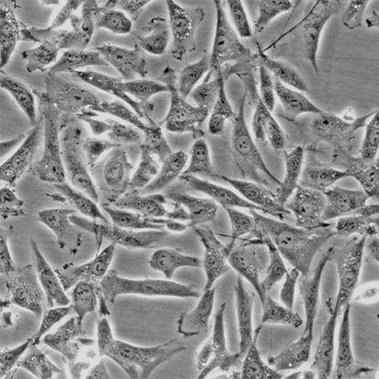 Human Hair Outer Root Sheath Cells