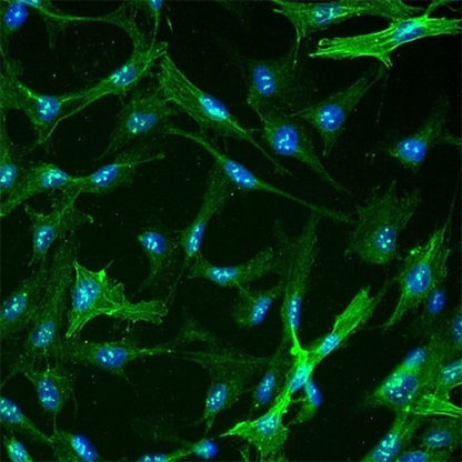 Human Hepatic Stellate Cells