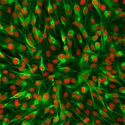 Human Intrahepatic Biliary Epithelial Cells