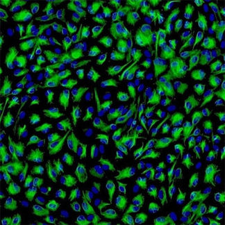 Human Iris Pigment Epithelial cells