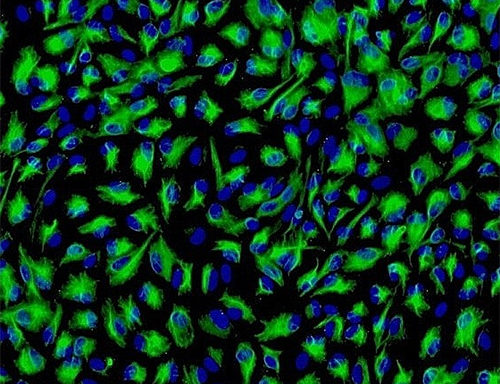 Human Iris Pigment Epithelial Cells