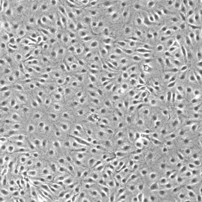 Human Lymphatic Endothelial Cells