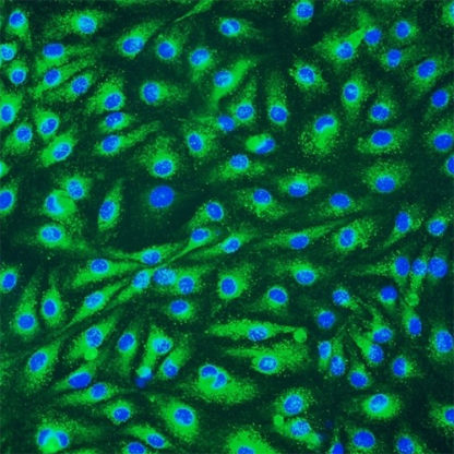 Human Lymphatic Endothelial Cells