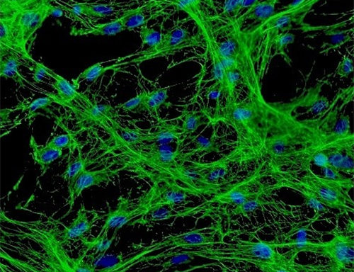 Green Fluorescent Human Meningeal Cells