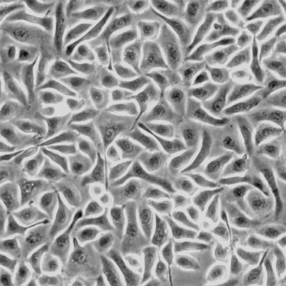 Human Mammary Epithelial Cells