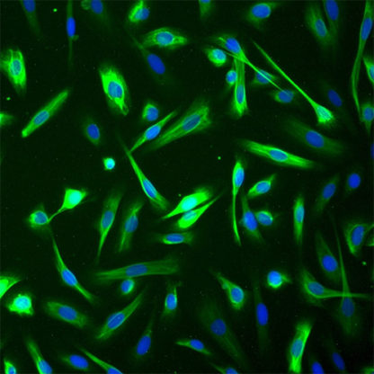 Human Mammary Epithelial Cells