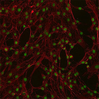 Human Mammary Fibroblasts