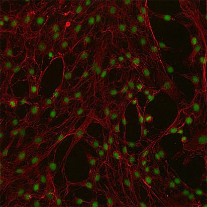 Human Mammary Fibroblasts