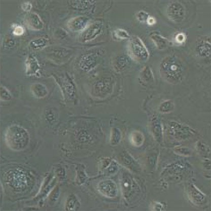 Human Mesothelial Cells