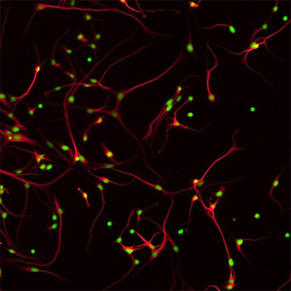 Human Cortical Neurons