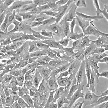 Human Non-Pigmented Ciliary Epithelial Cells