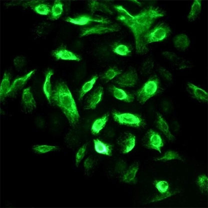 Human Oral Keratinocytes