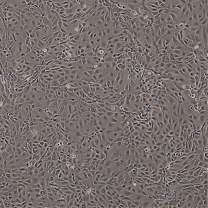 Human Pancreatic Epithelial Cells