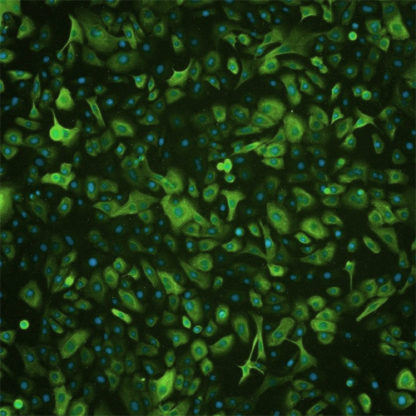 Human Pancreatic Epithelial Cells