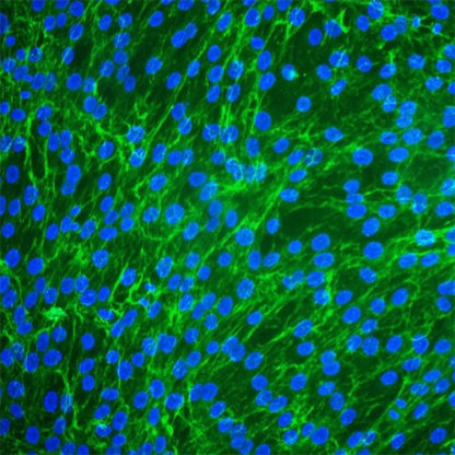 Human Periodontal Ligament Fibroblasts