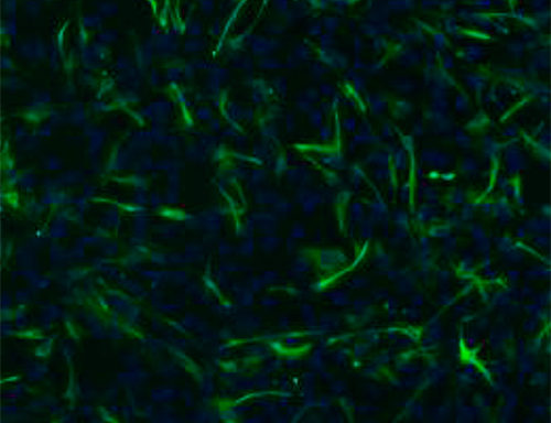 Green Fluorescent Human Retinal Astrocytes