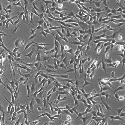 Human Rectal Fibroblasts