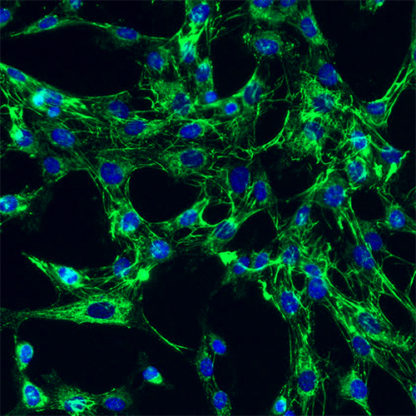 Human Rectal Fibroblasts