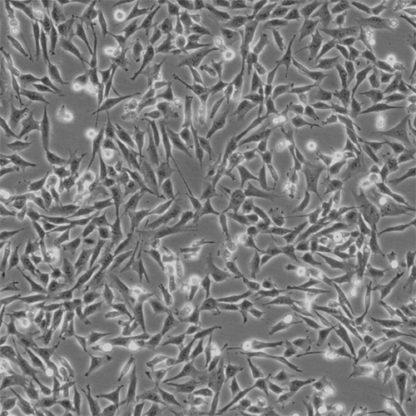 Human Rectal Smooth Muscle Cells