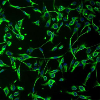 Human Schwann Cells