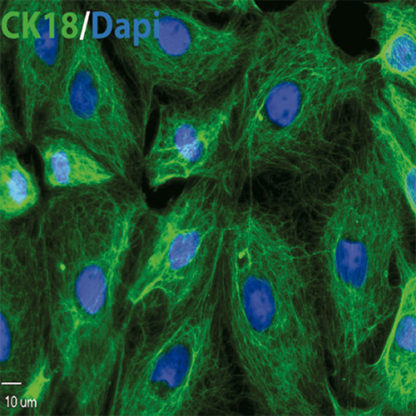 Human Small Intestine Epithelial Cells