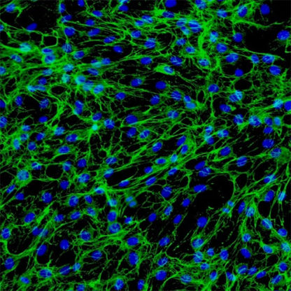 Human Small Intestine Fibroblasts