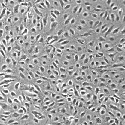 Human Small Intestine Microvascular Endothelial Cells