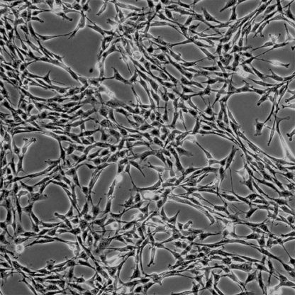 Human Thymic Epithelial Cells