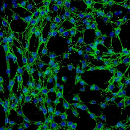 Human Thymic Epithelial Cells