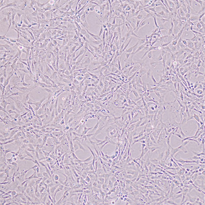 Immortalized Pancreatic Stromal Cells 1