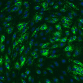 Mouse Hepatic Sinusoidal Endothelial cells