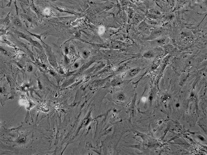 Mouse Renal Mesangial Cells