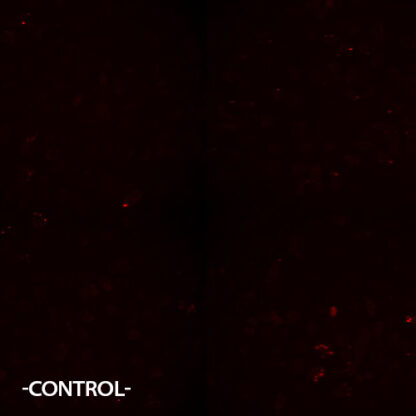 adenosine A2B receptor (ADORA2B) cell line