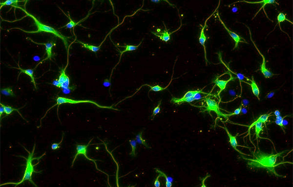 Rat Neurons – cortical