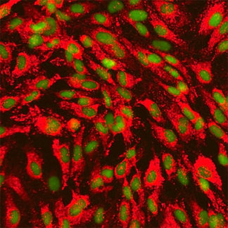 Human Pancreatic Endothelial Cells