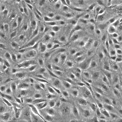 Human Pancreatic Endothelial Cells