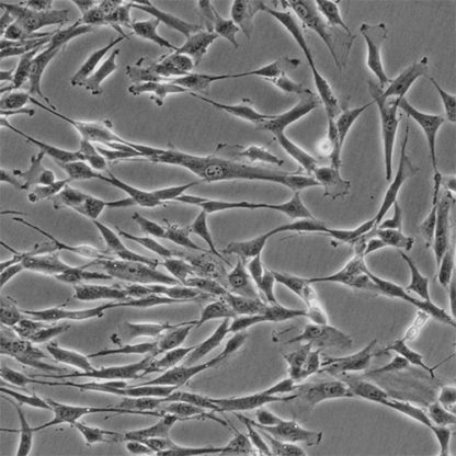 Human Pancreatic Stellate Cells