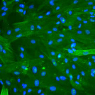 Human Pancreatic Stellate Cells