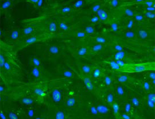 Green Fluorescent Human Pancreatic Stellate Cells